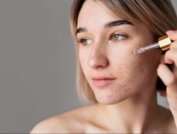 Catat! 5 Bahan Aktif Skincare Ini Bisa Bikin Iritasi Sampai Alergi Jika Digunakan Bersamaan dengan Retinol