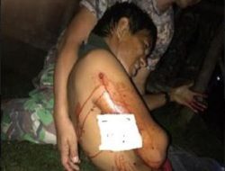 Para Pekerja Proyek Jalan Trans Papua Diberondong Peluru oleh OTK, 1 Terluka
