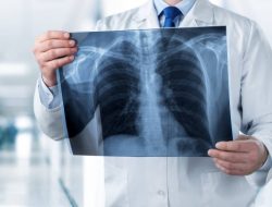 Ratusan Dokter Radiologi Tak Bisa Praktik karena Ditolak KKI, Pengurus Besar IDI Buka Suara