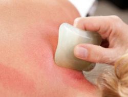 Sederet Manfaat Kerokan, Tak Hanya Bikin Badan Terasa Enteng